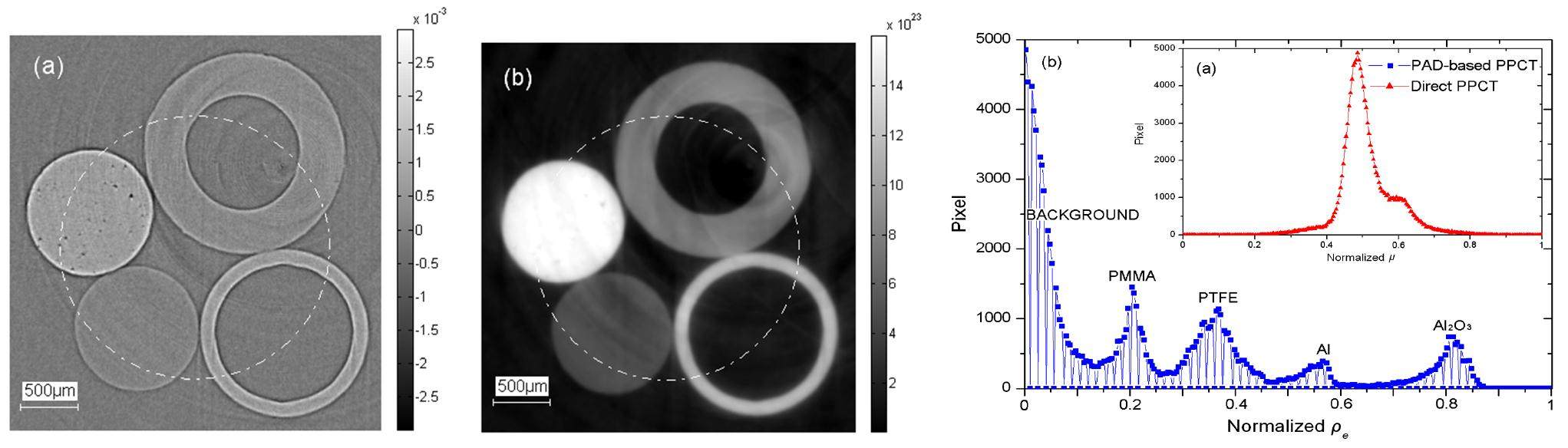 Latest advances of X-ray imaging and biomedical applications beamline ...