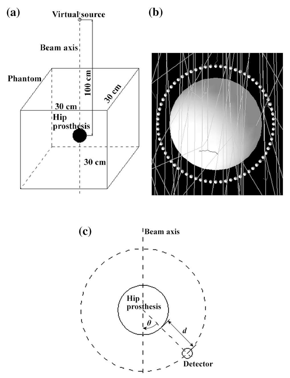 An investigation on the dosimetric impact of hip prosthesis in radiotherapy
