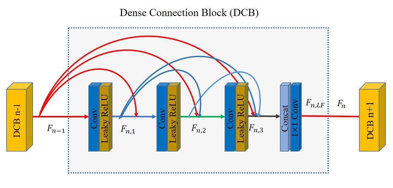 Sinogram denoising via attention residual dense convolutional neural ...