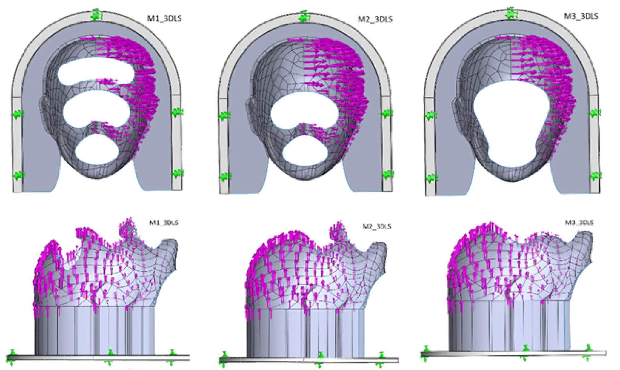 Radiotherapy customized head immobilization masks: from modeling and ...