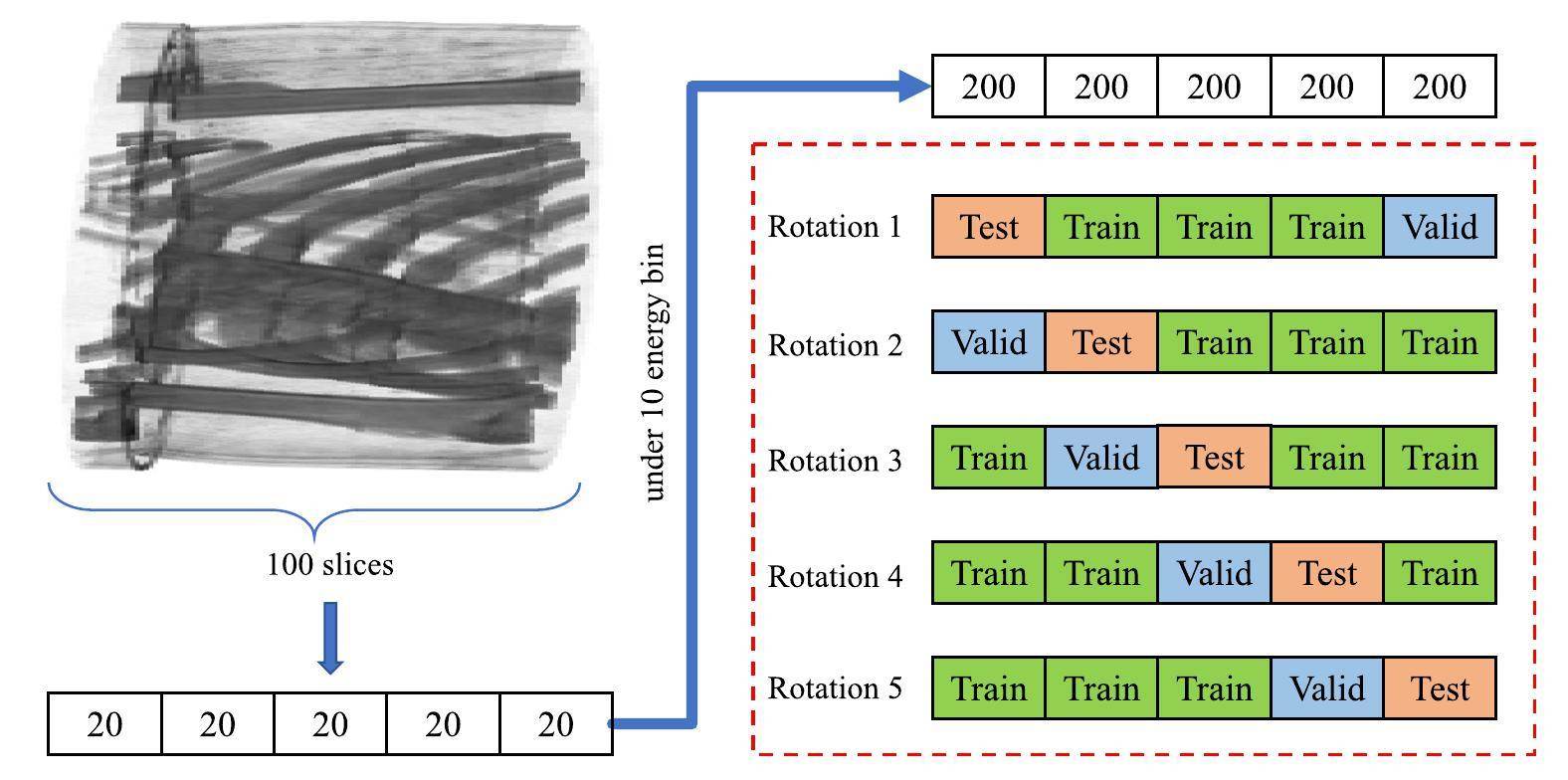 Material decomposition of spectral CT images via attention-based global ...