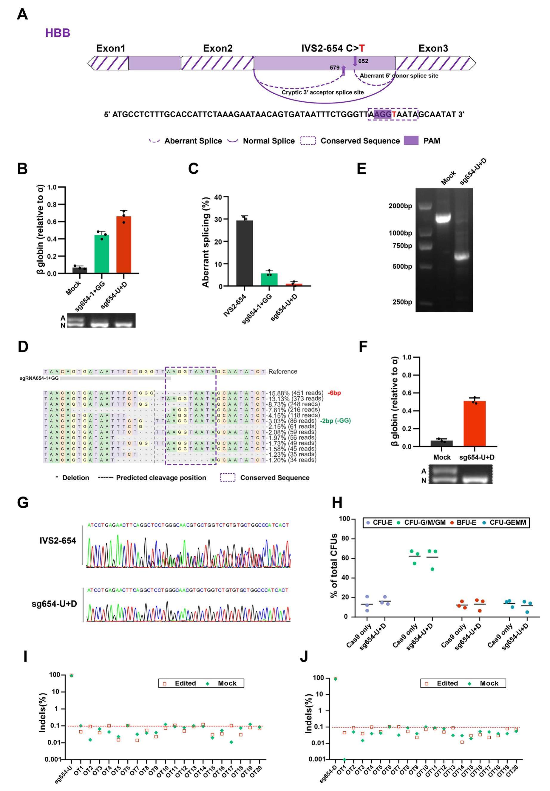 Therapeutic genome editing of an aberrant splice site in β-thalassemia ...